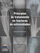 Principios de tratamiento en fracturas de extremidades
