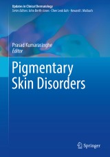 Pigmentary Skin Disorders