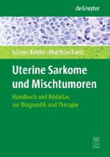 Uterine Sarkome und Mischtumoren