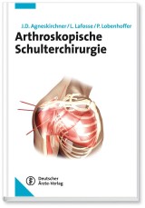 Arthroskopische Schulterchirurgie