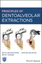 Principles of Dentoalveolar Extractions
