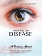 Inside the Eye Disease Just the Facts