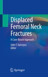 Displaced Femoral Neck Fractures