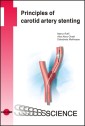 Principles of carotid artery stenting