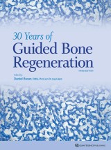 30 Years of Guided Bone Regeneration