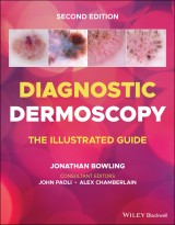 Diagnostic Dermoscopy
