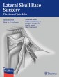 Lateral Skull Base Surgery