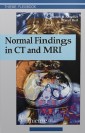 Normal Findings in CT and MRI