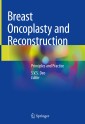 Breast Oncoplasty and Reconstruction
