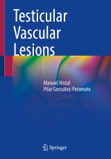 Testicular Vascular Lesions