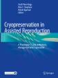 Cryopreservation in Assisted Reproduction