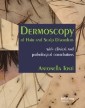 Dermoscopy of Hair and Scalp Disorders