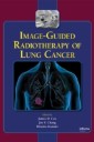 Image-Guided Radiotherapy of Lung Cancer