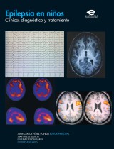 Epilepsia en niños