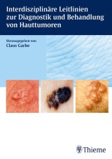 Interdisziplinäre Leitlinien zur Diagnostik und Behandlung von Hauttumoren