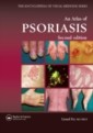Atlas of Psoriasis