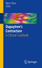 Dupuytren's Contracture