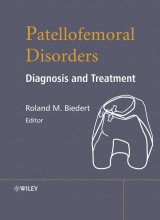 Patellofemoral Disorders