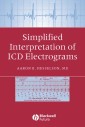 Simplified Interpretation of ICD Electrograms