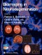 Bioimaging in Neurodegeneration