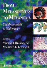 From Melanocytes to Melanoma