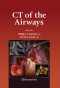 CT of the Airways