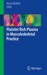 Platelet Rich Plasma in Musculoskeletal Practice