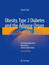 Obesity, Type 2 Diabetes and the Adipose Organ